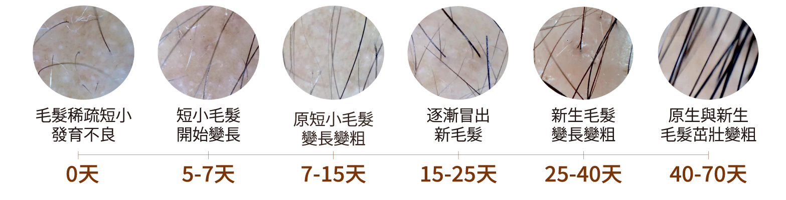 毛髮生長時間軸